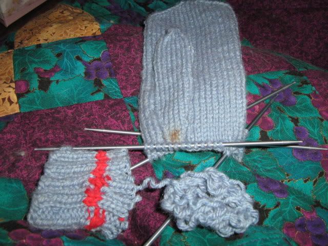 mitten surgery