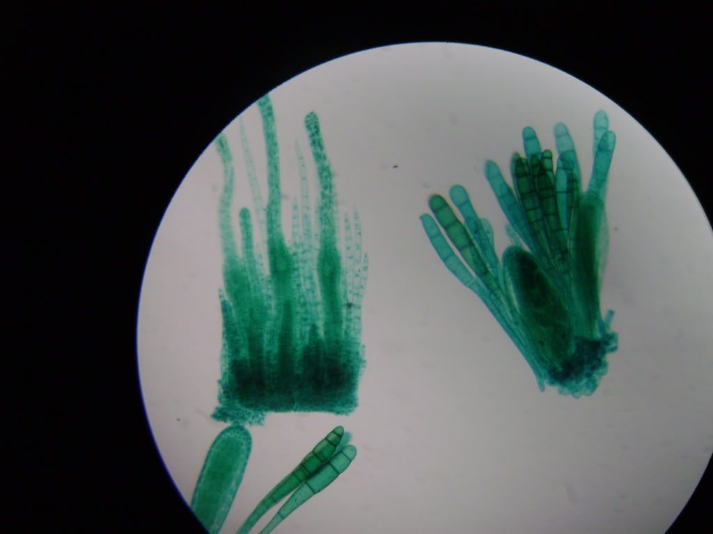 moss antheridium