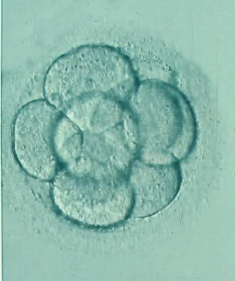 IVF Success Enhanced By New Method Of Assessing Womens Eggs